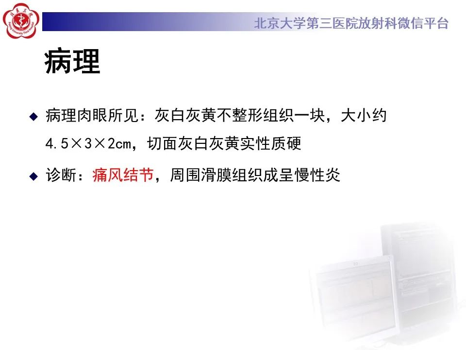 影像PPT - 【PPT】痛风性膝关节炎-9