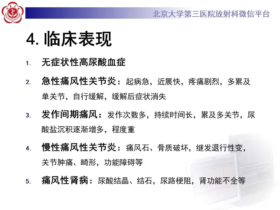 影像PPT - 【PPT】痛风性膝关节炎-17