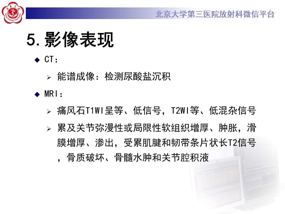 影像PPT - 【PPT】痛风性膝关节炎-19