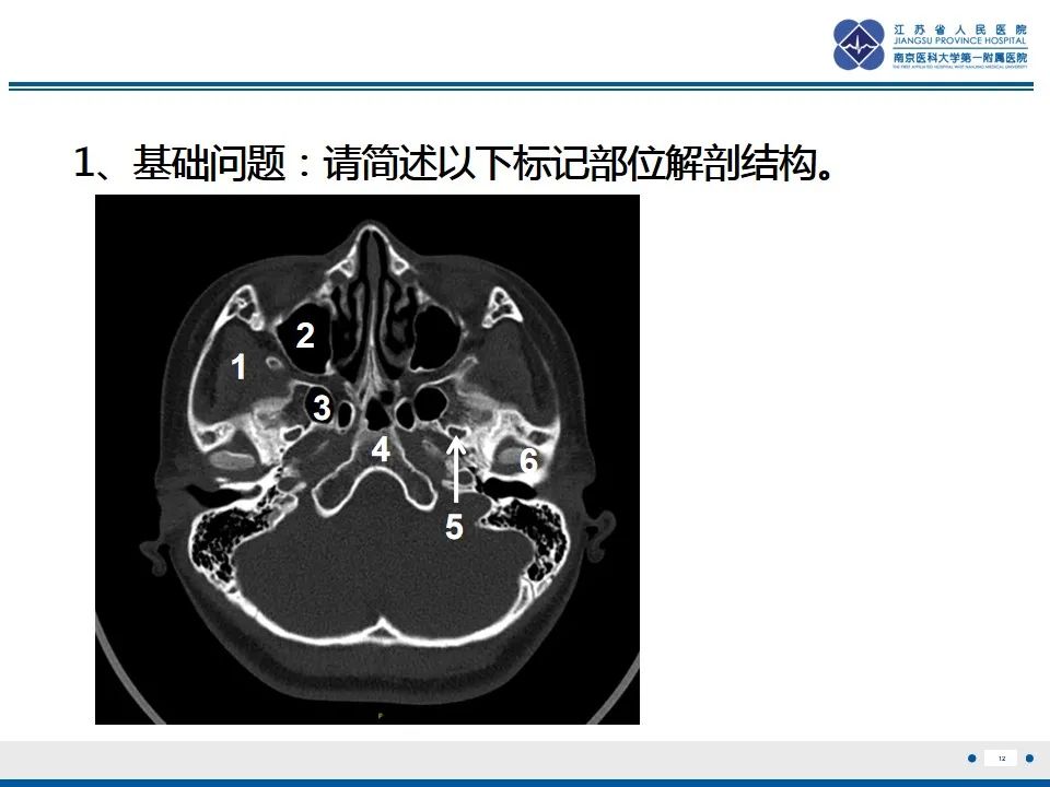 影像PPT - 【PPT】鼻腔鼻窦鳞状细胞癌-13