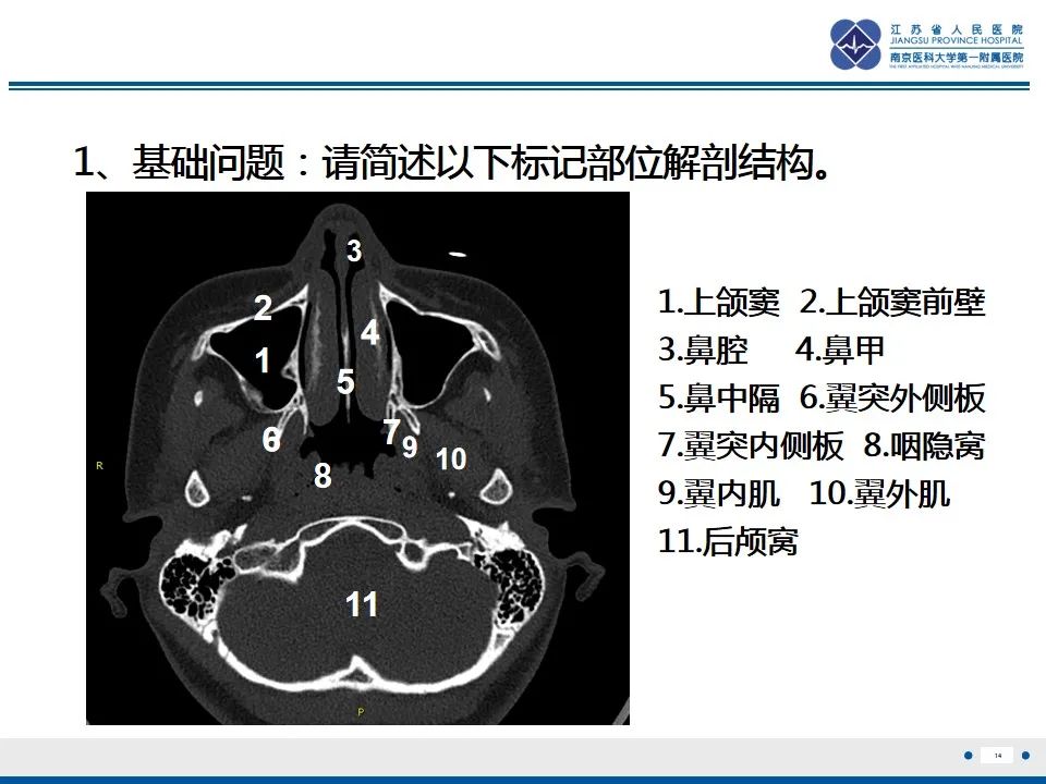 影像PPT - 【PPT】鼻腔鼻窦鳞状细胞癌-15