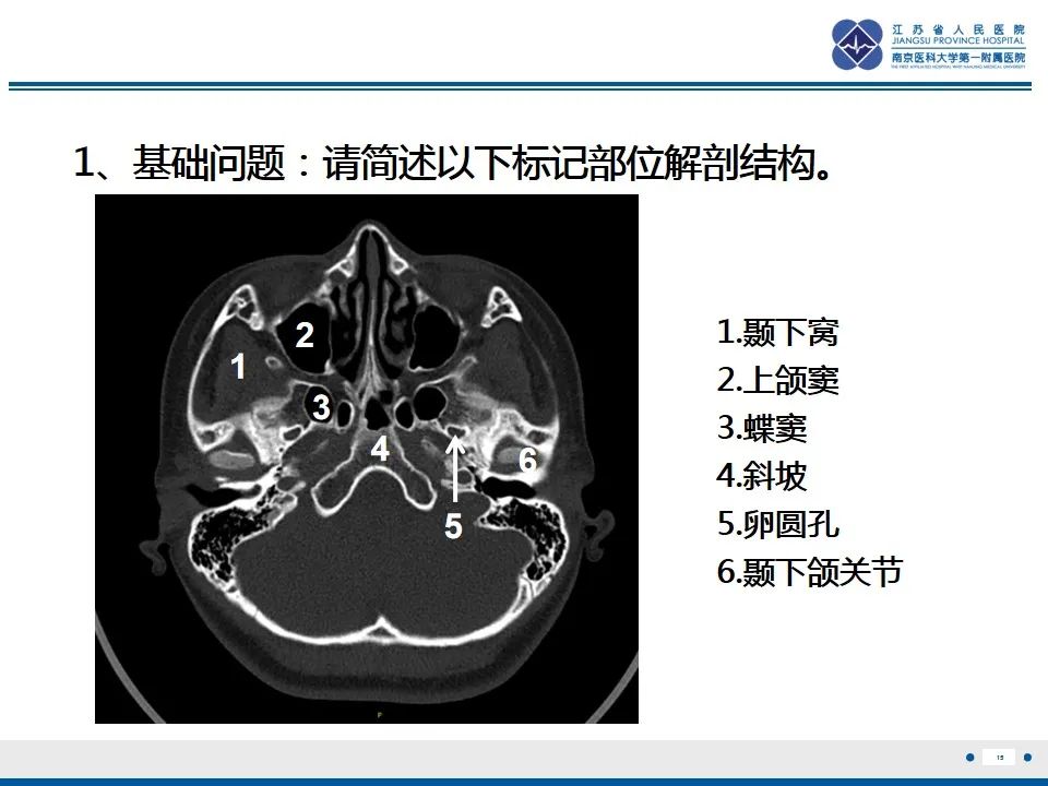 影像PPT - 【PPT】鼻腔鼻窦鳞状细胞癌-16