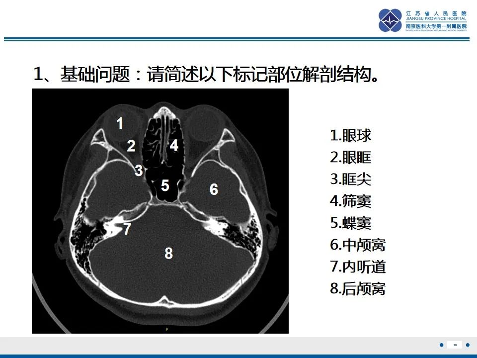 影像PPT - 【PPT】鼻腔鼻窦鳞状细胞癌-17