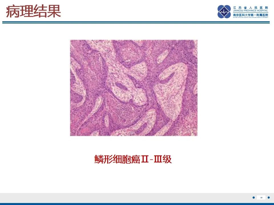 影像PPT - 【PPT】鼻腔鼻窦鳞状细胞癌-23