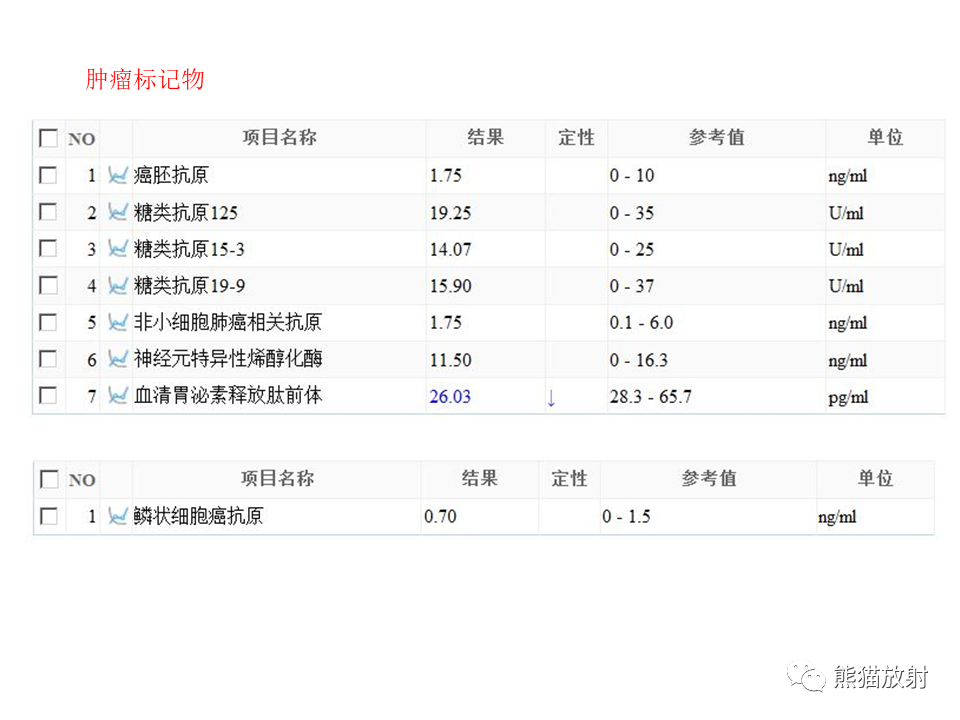 影像PPT - 【病例】肺隐球菌病2例CT影像-3