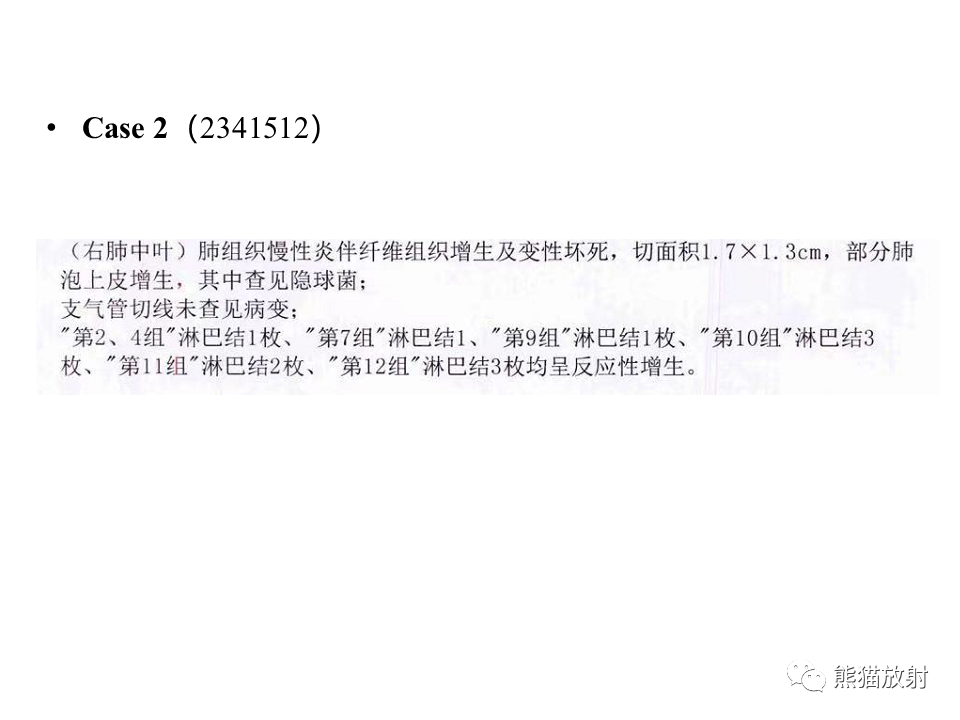 影像PPT - 【病例】肺隐球菌病2例CT影像-25