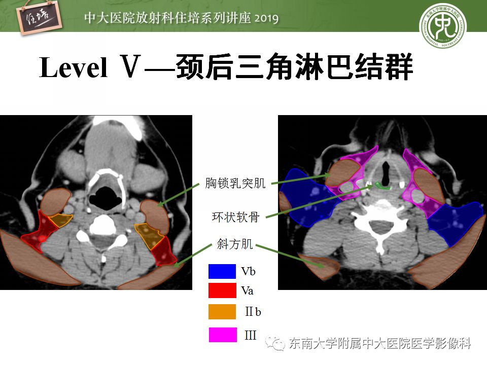 影像PPT - 【PPT】颈部淋巴结的影像解剖及常见病变的影像表现-16