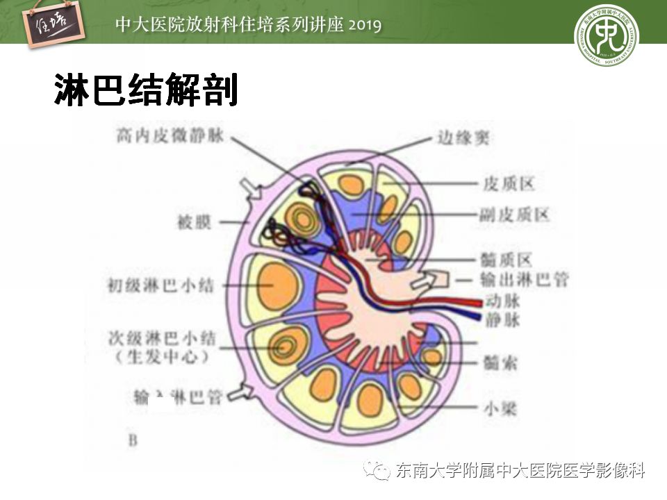 影像PPT - 【PPT】颈部淋巴结的影像解剖及常见病变的影像表现-21