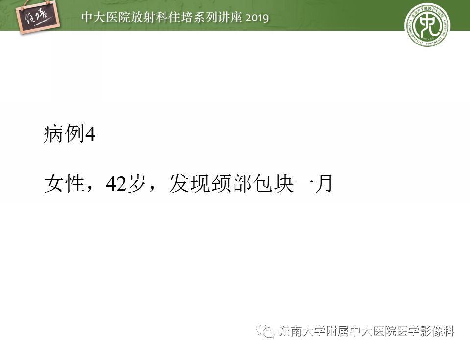影像PPT - 【PPT】颈部淋巴结的影像解剖及常见病变的影像表现-32
