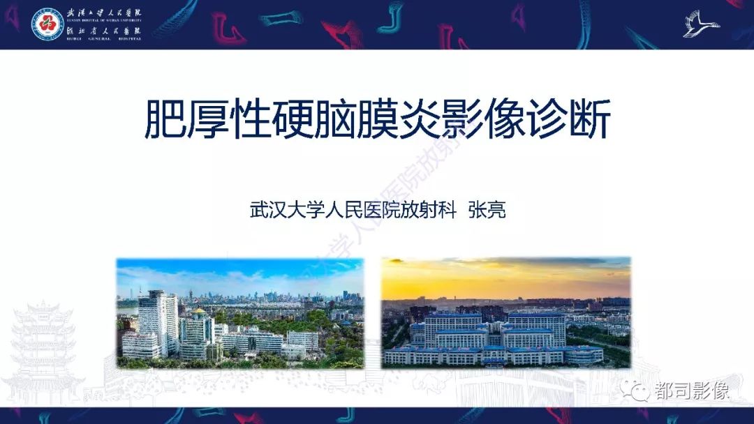 影像PPT - 【PPT】肥厚性硬脑膜炎影像诊断-1