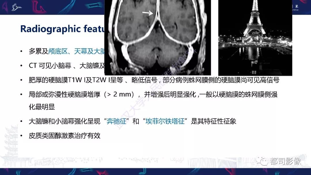 影像PPT - 【PPT】肥厚性硬脑膜炎影像诊断-13