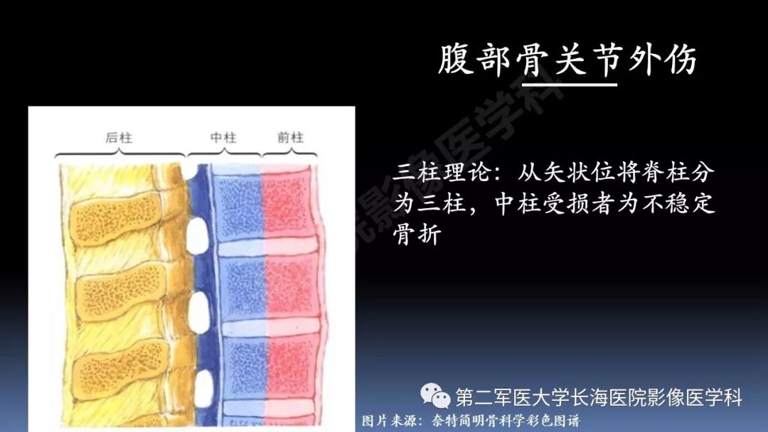 影像PPT - 【PPT】急腹症CT读片思路解析-20