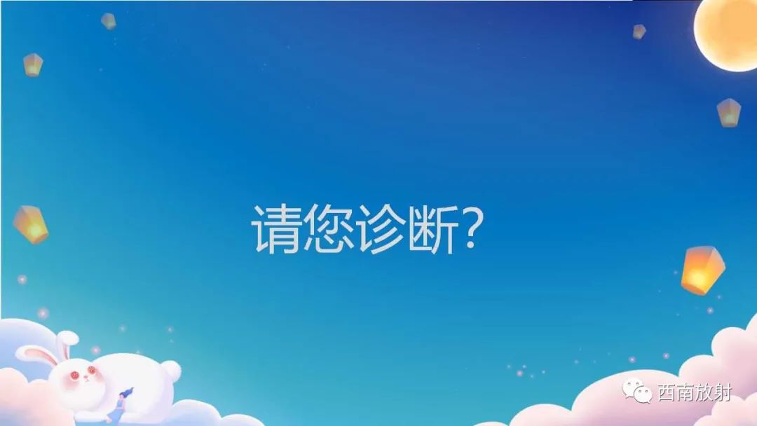 影像PPT - 【病例】腮腺腺淋巴瘤1例CT影像-9