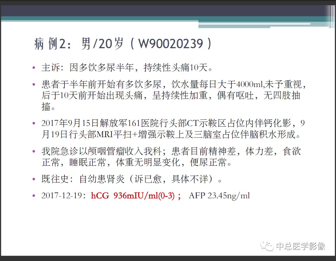 影像PPT - 【PPT】颅内生殖细胞瘤影像诊断-6