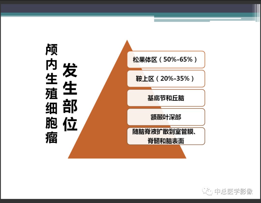 影像PPT - 【PPT】颅内生殖细胞瘤影像诊断-11