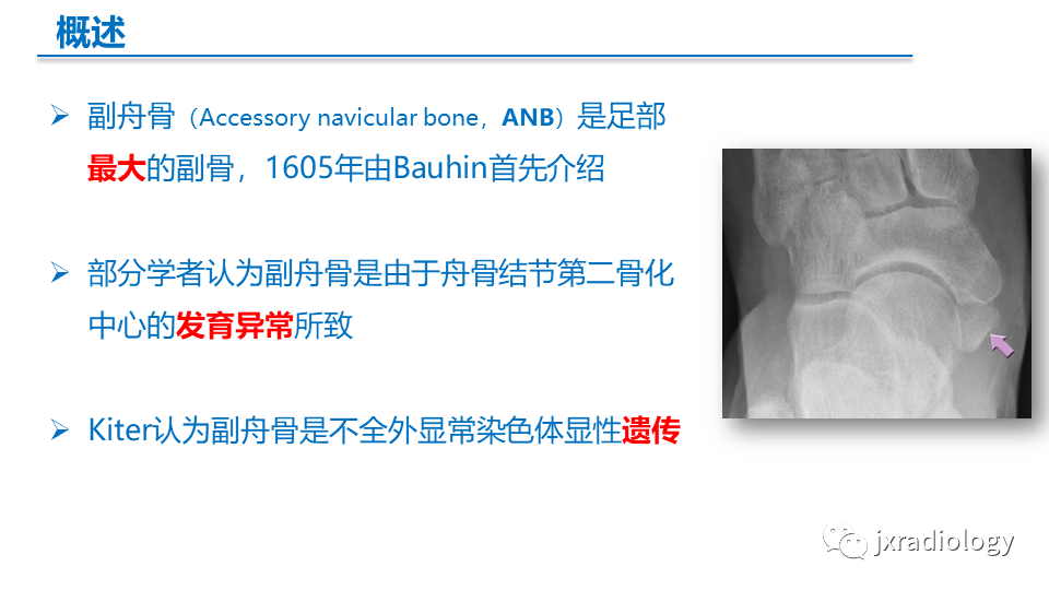 影像PPT - 【PPT】足副舟骨分型及相关病变-2