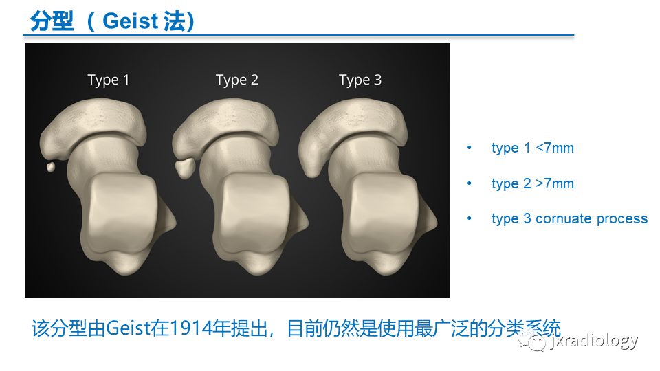影像PPT - 【PPT】足副舟骨分型及相关病变-4