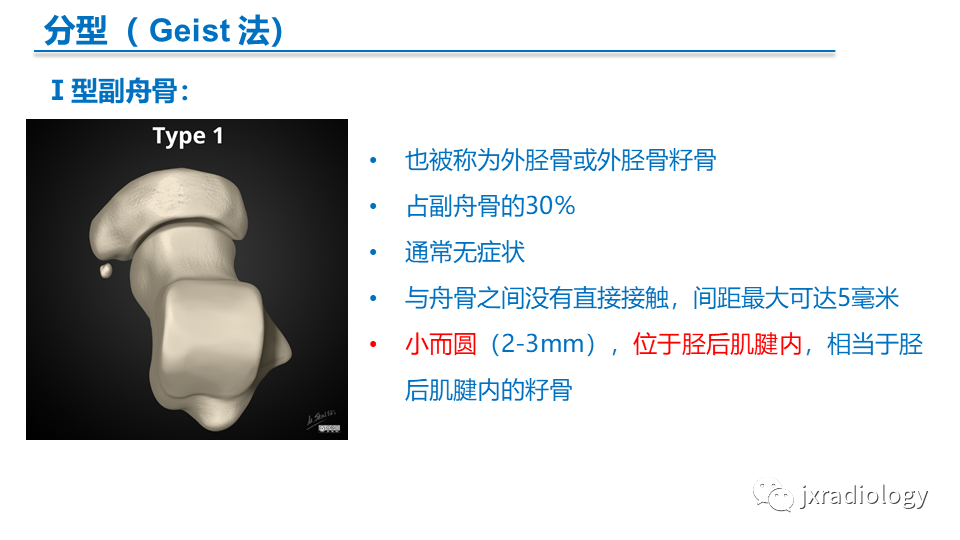 影像PPT - 【PPT】足副舟骨分型及相关病变-5