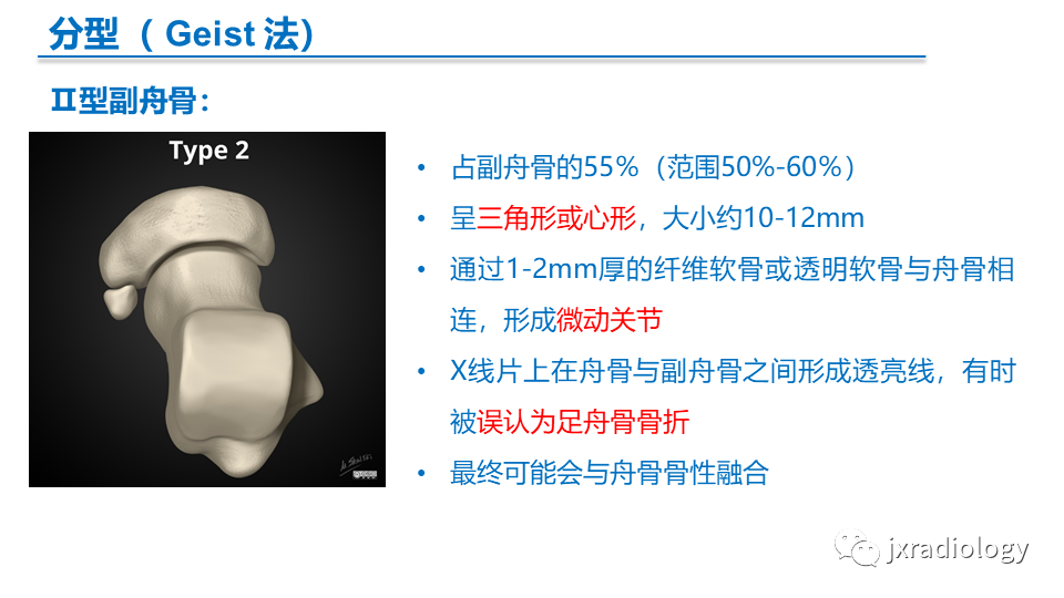 影像PPT - 【PPT】足副舟骨分型及相关病变-6