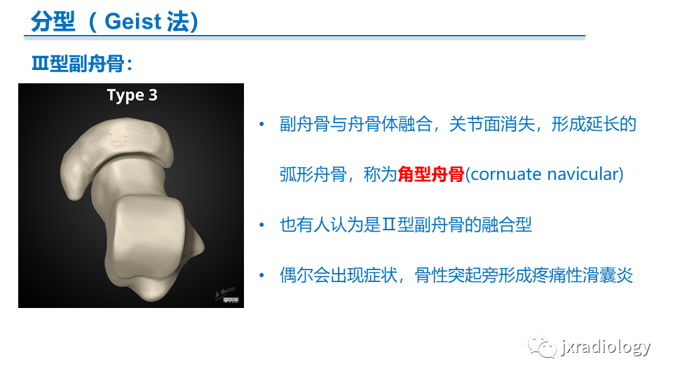 影像PPT - 【PPT】足副舟骨分型及相关病变-7