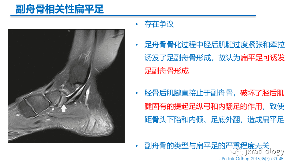 影像PPT - 【PPT】足副舟骨分型及相关病变-27