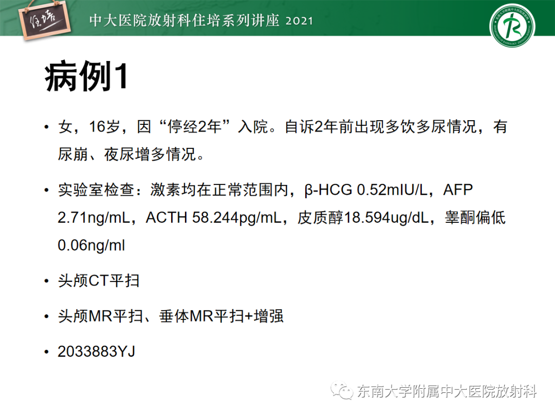 影像PPT - 【PPT】颅内生殖细胞瘤影像学表现及鉴别-6
