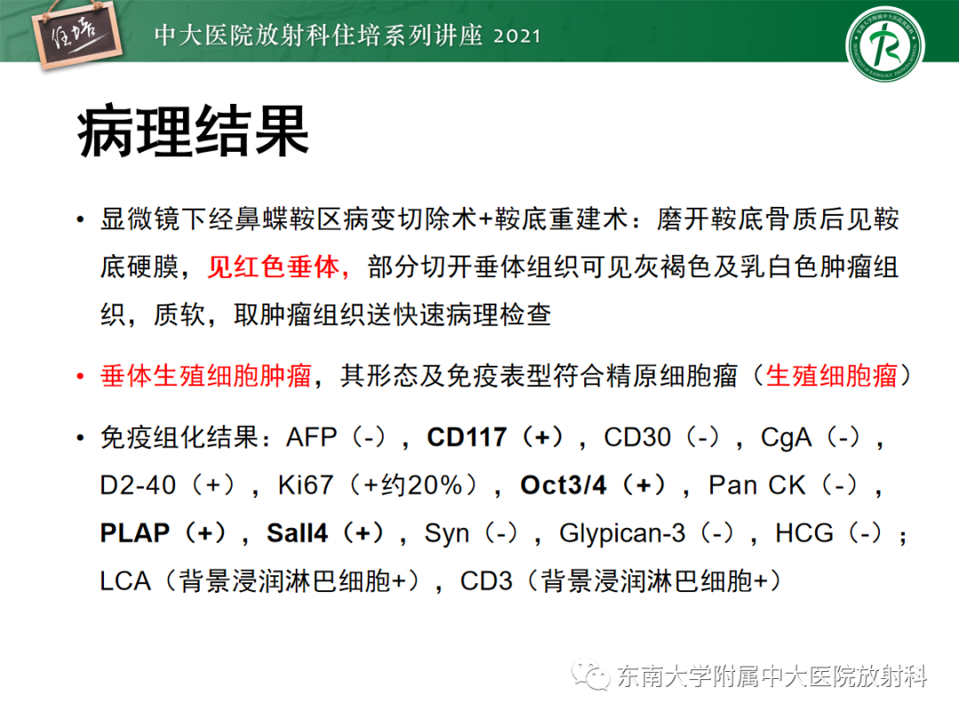 影像PPT - 【PPT】颅内生殖细胞瘤影像学表现及鉴别-10