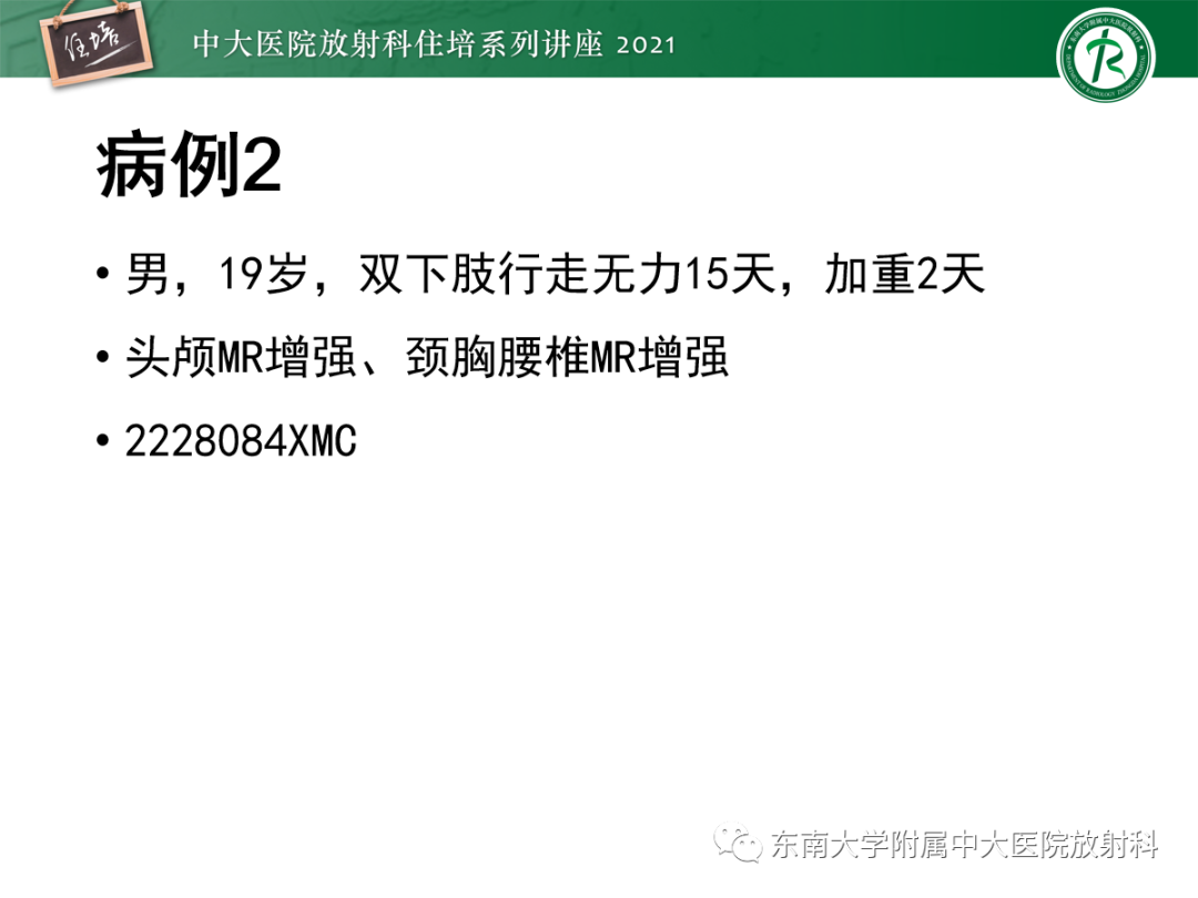 影像PPT - 【PPT】颅内生殖细胞瘤影像学表现及鉴别-11