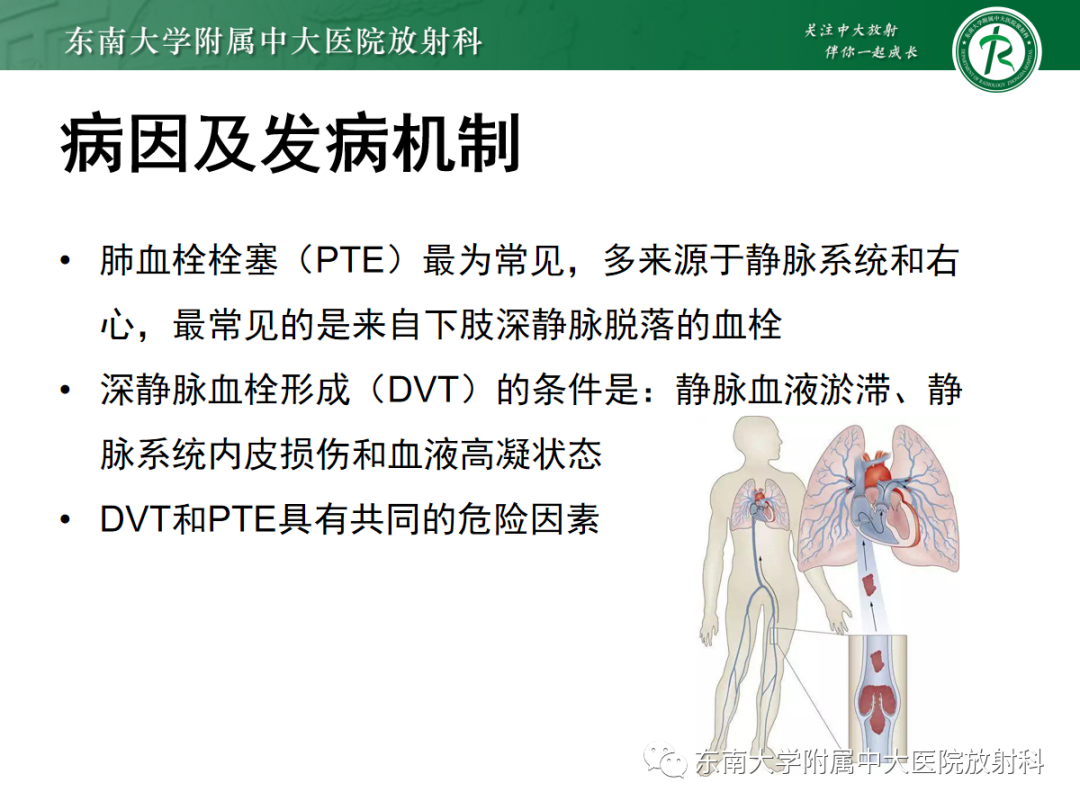 影像PPT - 【PPT】胸痛三联征-16 影像PPT - 【PPT】胸痛三联征-16