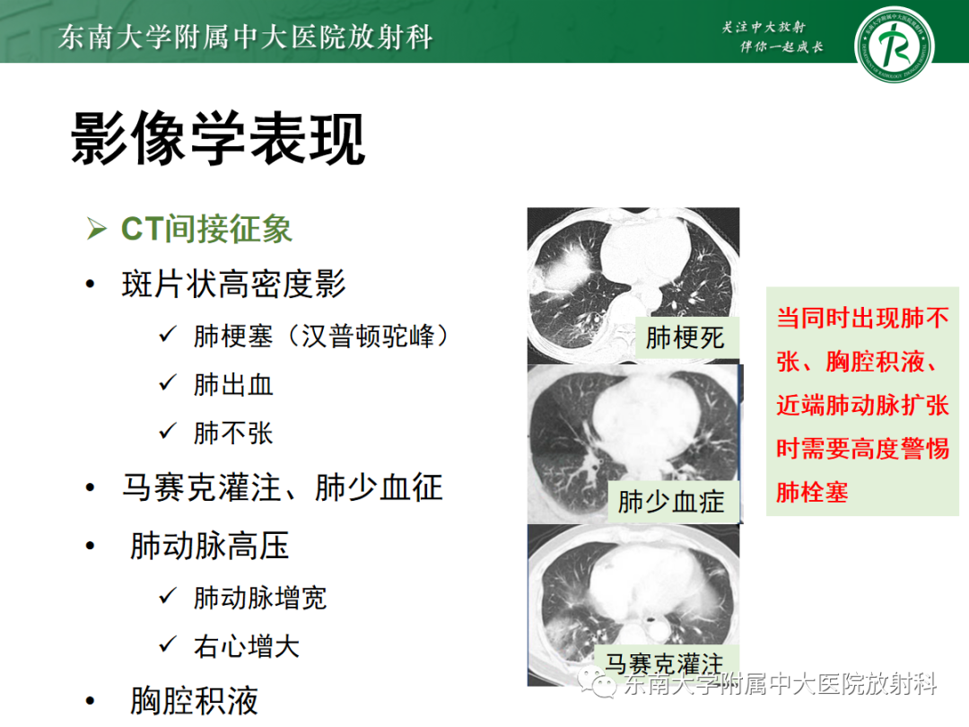影像PPT - 【PPT】胸痛三联征-21 影像PPT - 【PPT】胸痛三联征-21