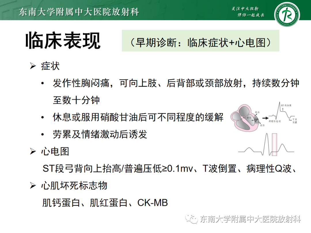 影像PPT - 【PPT】胸痛三联征-25 影像PPT - 【PPT】胸痛三联征-25