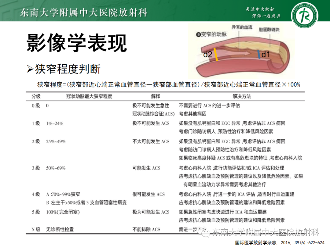 影像PPT - 【PPT】胸痛三联征-27 影像PPT - 【PPT】胸痛三联征-27