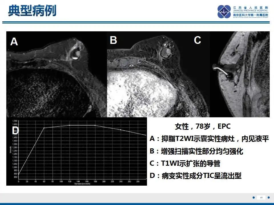 影像PPT - 【PPT】乳腺包裹性乳头状癌-24