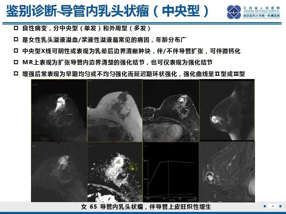 影像PPT - 【PPT】乳腺包裹性乳头状癌-27