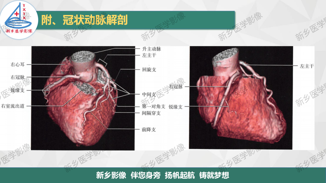 影像PPT - 【PPT】医学影像诊断学教材解读-4