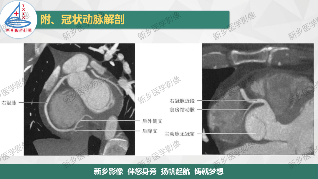 影像PPT - 【PPT】医学影像诊断学教材解读-6