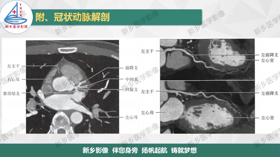 影像PPT - 【PPT】医学影像诊断学教材解读-9