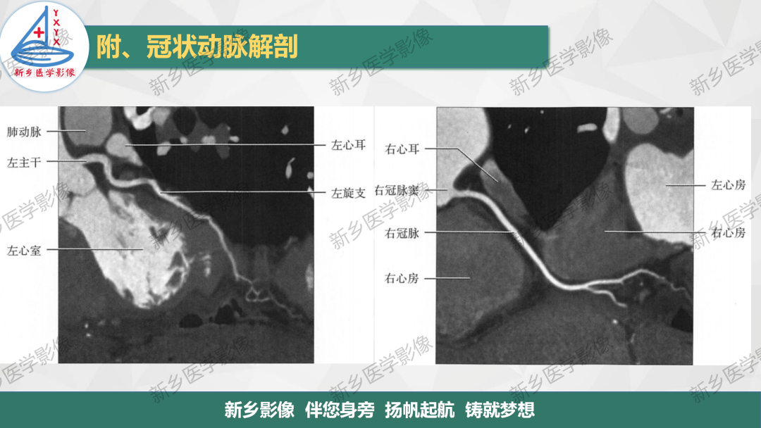 影像PPT - 【PPT】医学影像诊断学教材解读-10