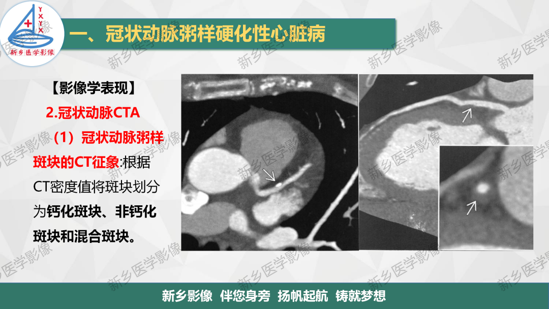 影像PPT - 【PPT】医学影像诊断学教材解读-15
