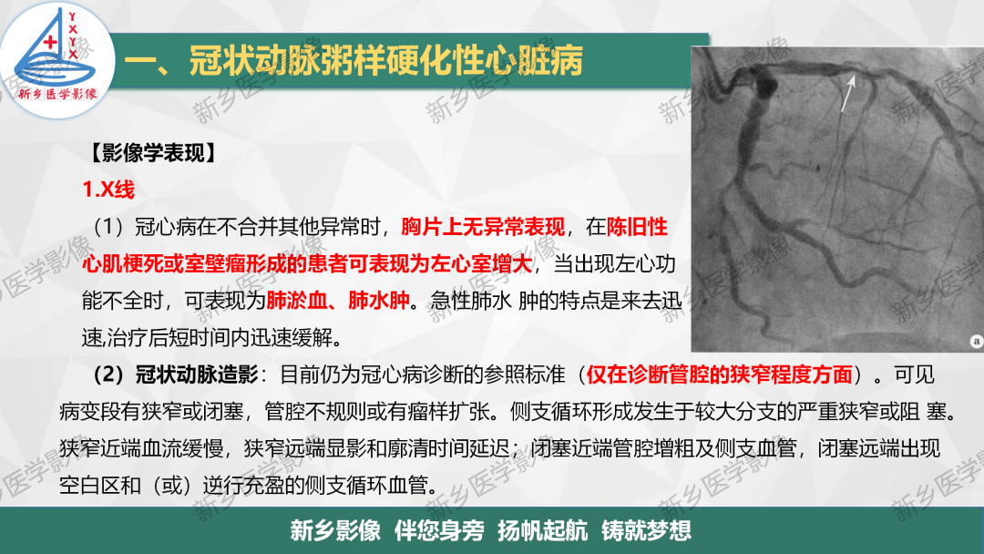 影像PPT - 【PPT】医学影像诊断学教材解读-14