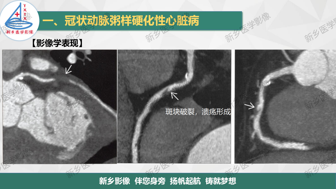 影像PPT - 【PPT】医学影像诊断学教材解读-17
