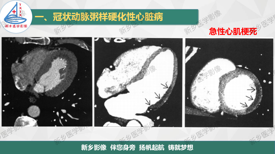 影像PPT - 【PPT】医学影像诊断学教材解读-20