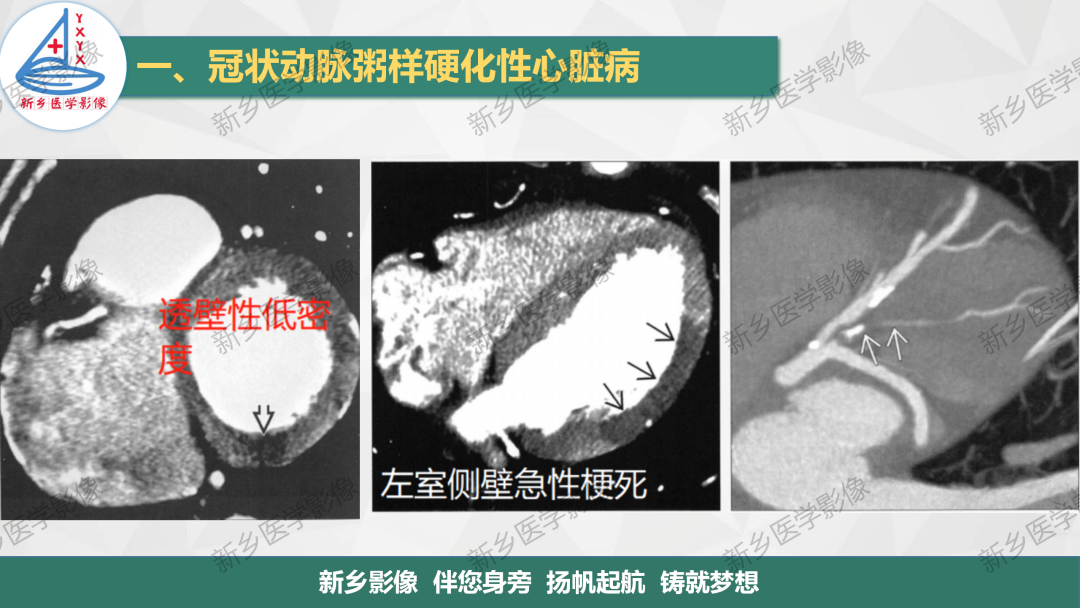 影像PPT - 【PPT】医学影像诊断学教材解读-19