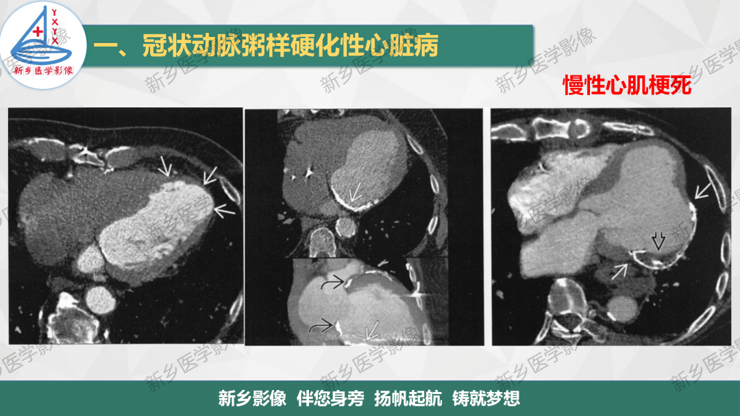影像PPT - 【PPT】医学影像诊断学教材解读-21