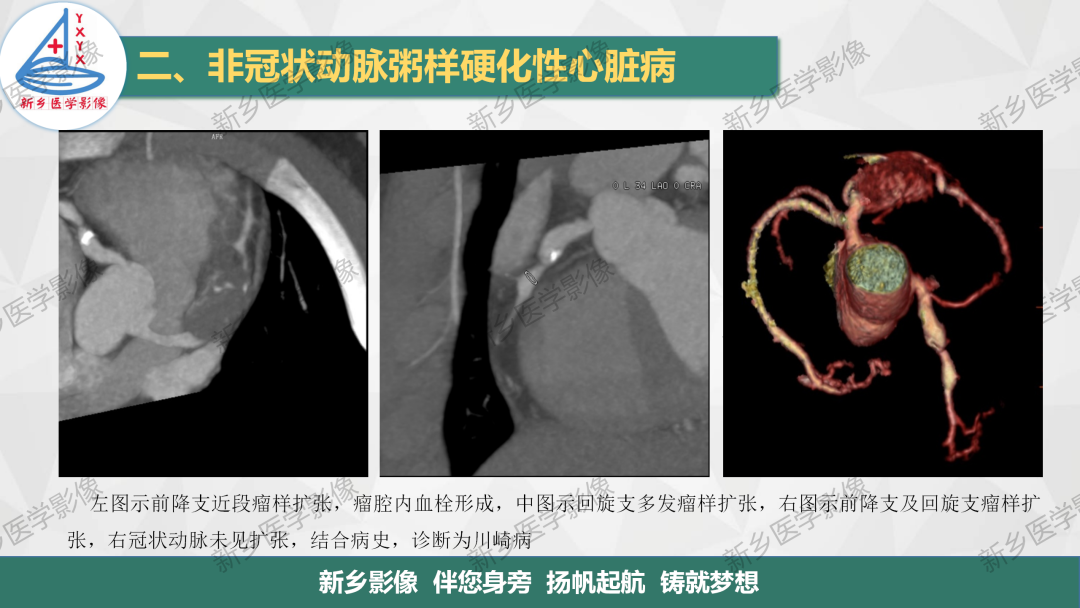影像PPT - 【PPT】医学影像诊断学教材解读-27