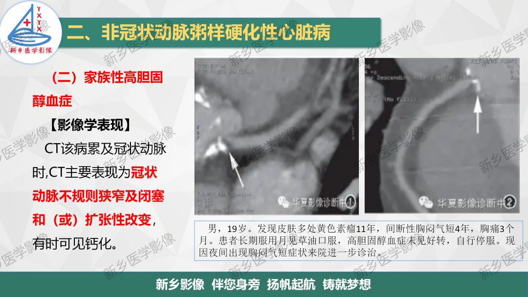 影像PPT - 【PPT】医学影像诊断学教材解读-30