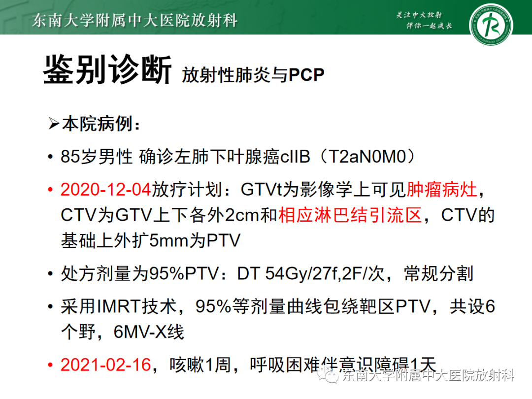 影像PPT - 【PPT】放射性肺损伤-21 影像PPT - 【PPT】放射性肺损伤-21