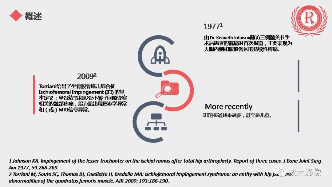 影像PPT - 【PPT】坐骨股骨撞击综合征MR影像诊断-3 影像PPT - 【PPT】坐骨股骨撞击综合征MR影像诊断-3