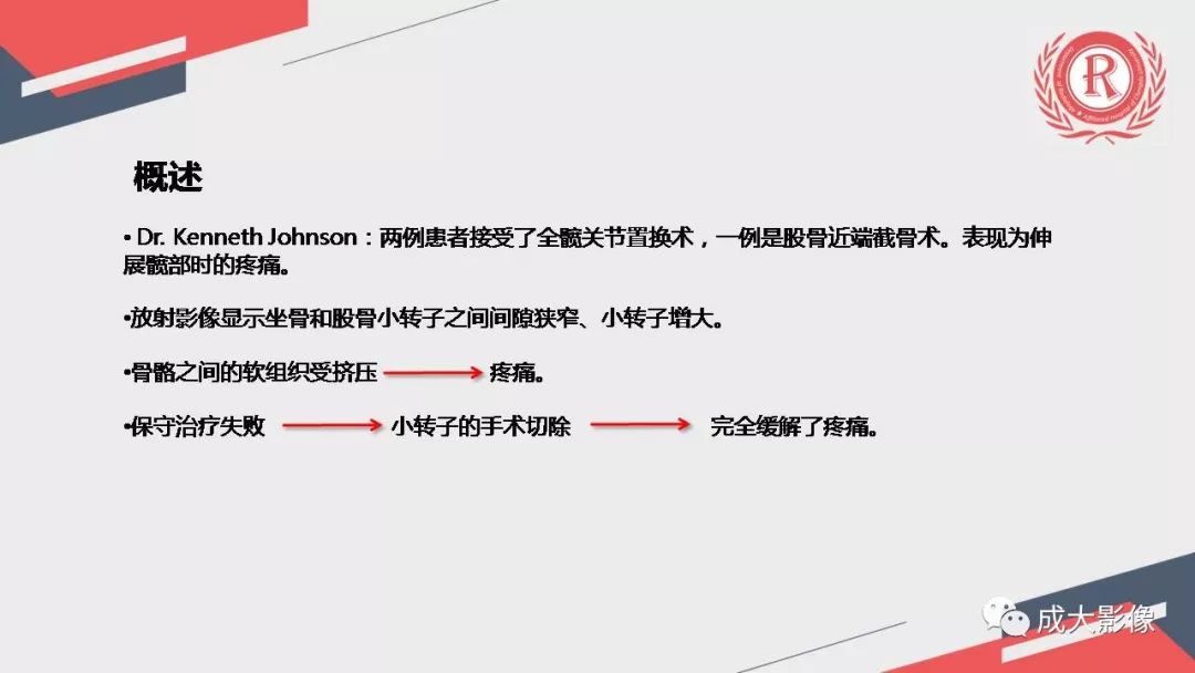影像PPT - 【PPT】坐骨股骨撞击综合征MR影像诊断-4 影像PPT - 【PPT】坐骨股骨撞击综合征MR影像诊断-4