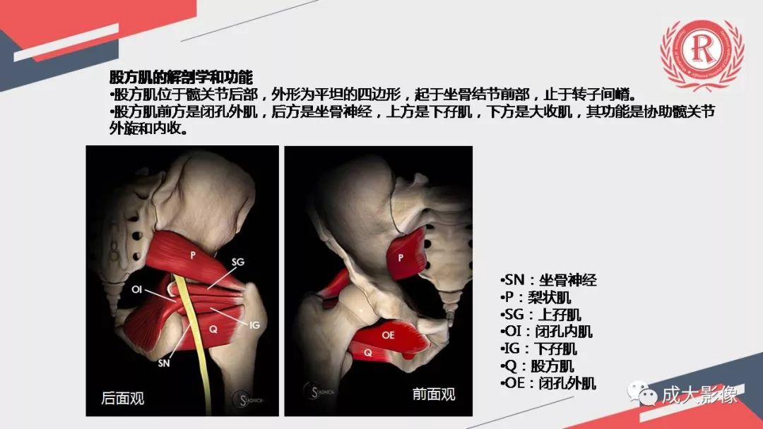 影像PPT - 【PPT】坐骨股骨撞击综合征MR影像诊断-7 影像PPT - 【PPT】坐骨股骨撞击综合征MR影像诊断-7